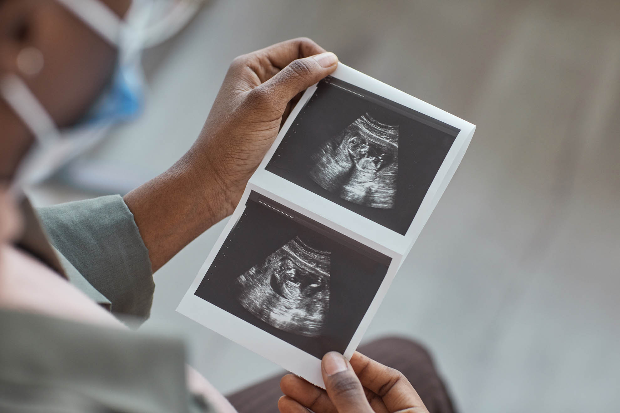 Ultrasound image in woman's hand